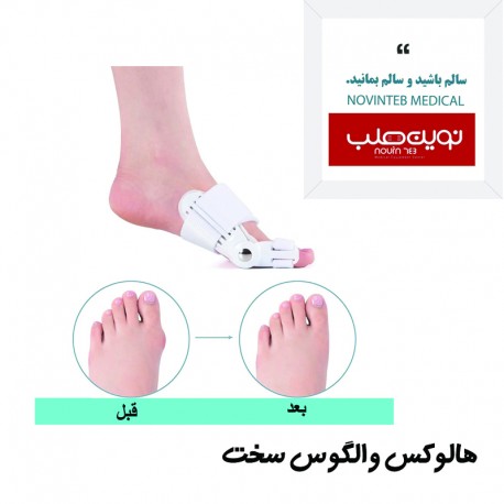 اسپلینت هالوکس والگوس سخت